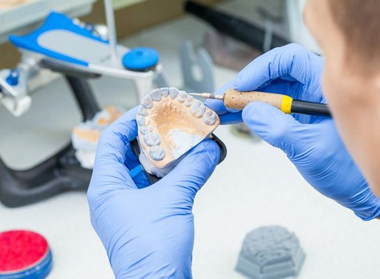 Dental lab technician adjusting a wax model of dentures