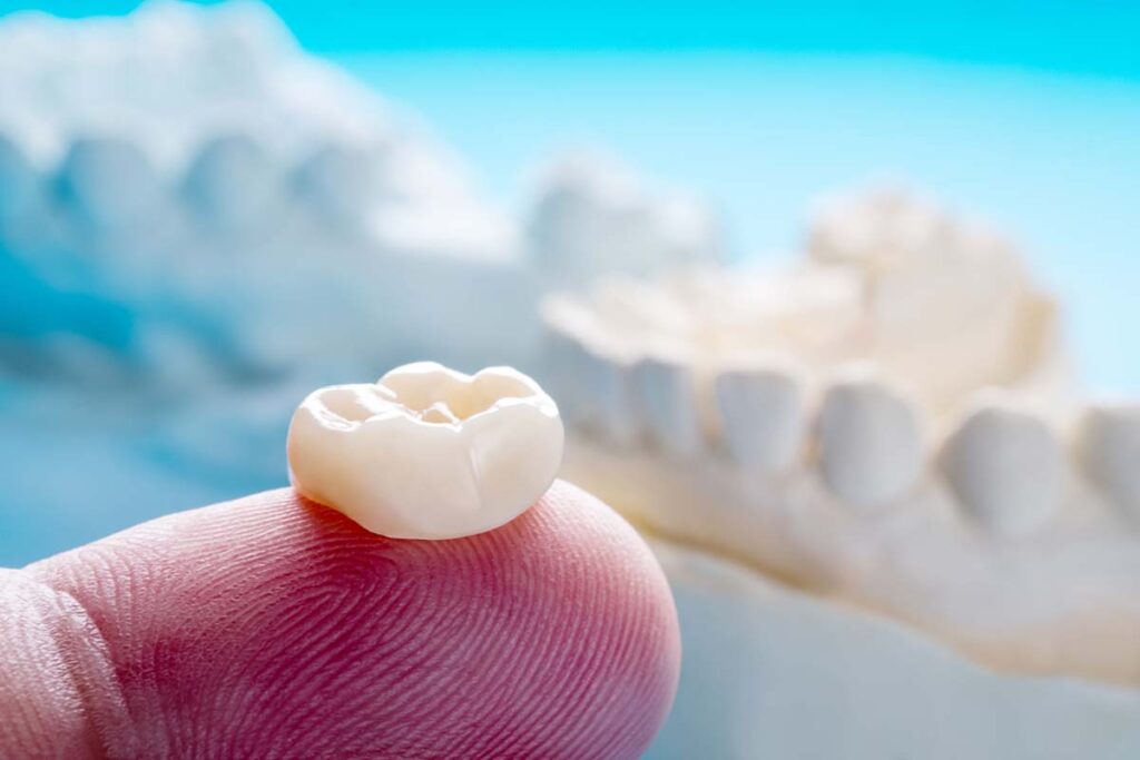 photo of a dental crown on dentist's fingertip who is explaining how long do dental crowns last