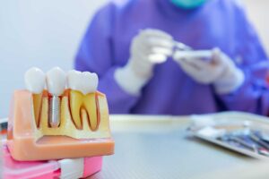 a dental professional sits working with a dental implant and explains some common dental implant myths