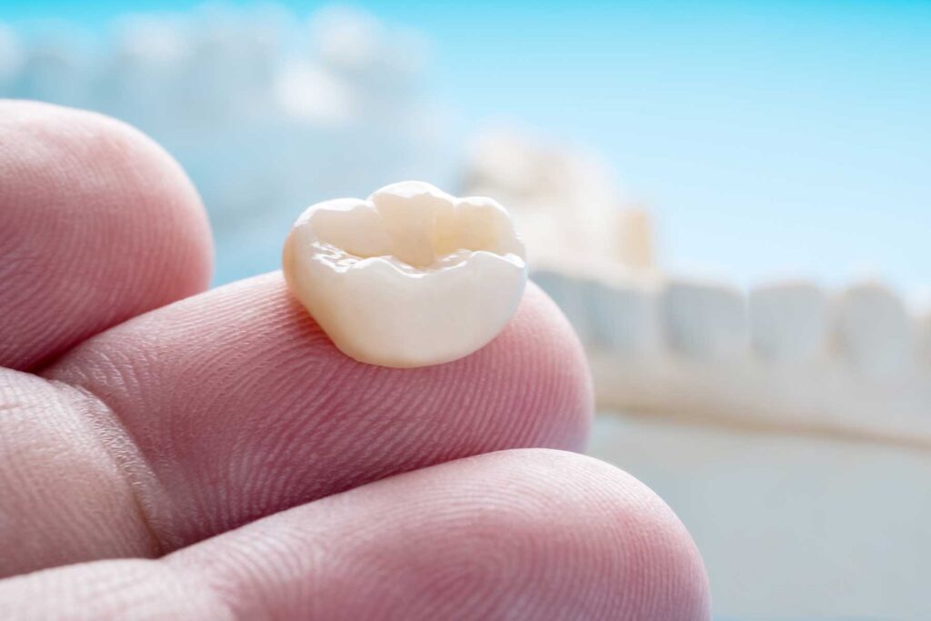 a person's hand holds a piece of a tooth on their finger tip and asking what is restorative dentistry
